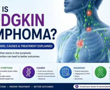 What Is Hodgkin Lymphoma Early Symptoms, Causes & Treatment Explained