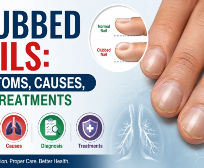 Clubbed Nails Symptoms, Causes, and Treatments