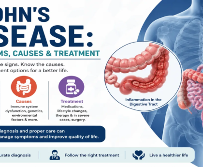 Crohn’s Disease Symptoms, Causes & Treatment Guide